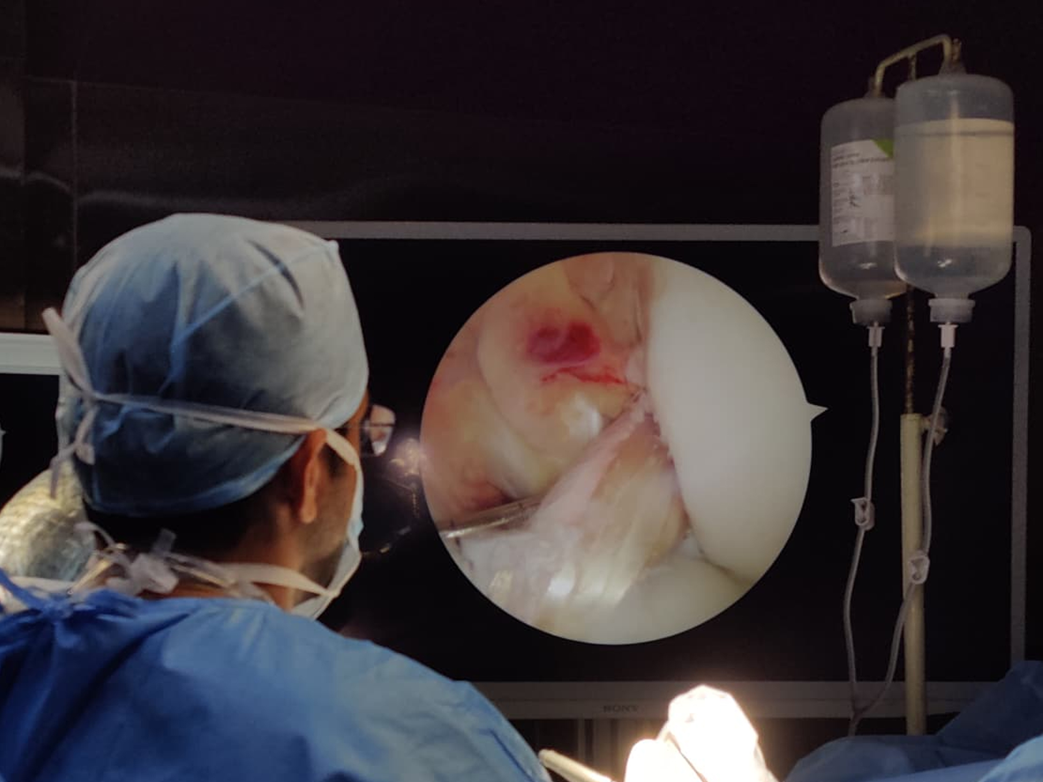 ACL & Knee Ligament Surgery in Salem | Dr. Shreeraam – Sports Injury Specialist 